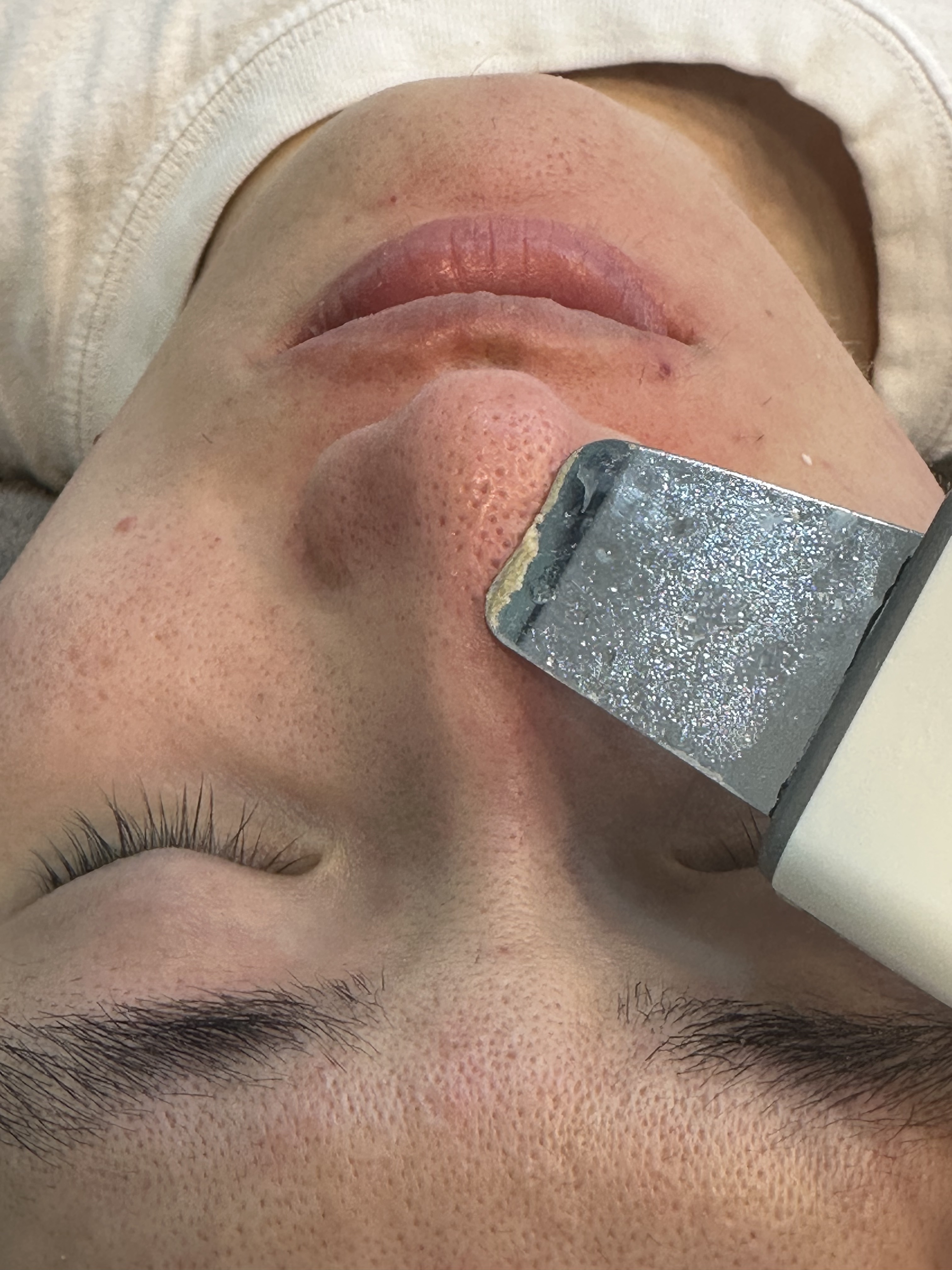 샤인온에스테틱 파주운정점 대표 이미지