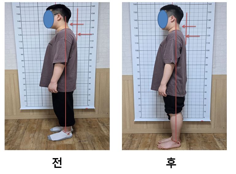 몸편한교정센터 photo 4