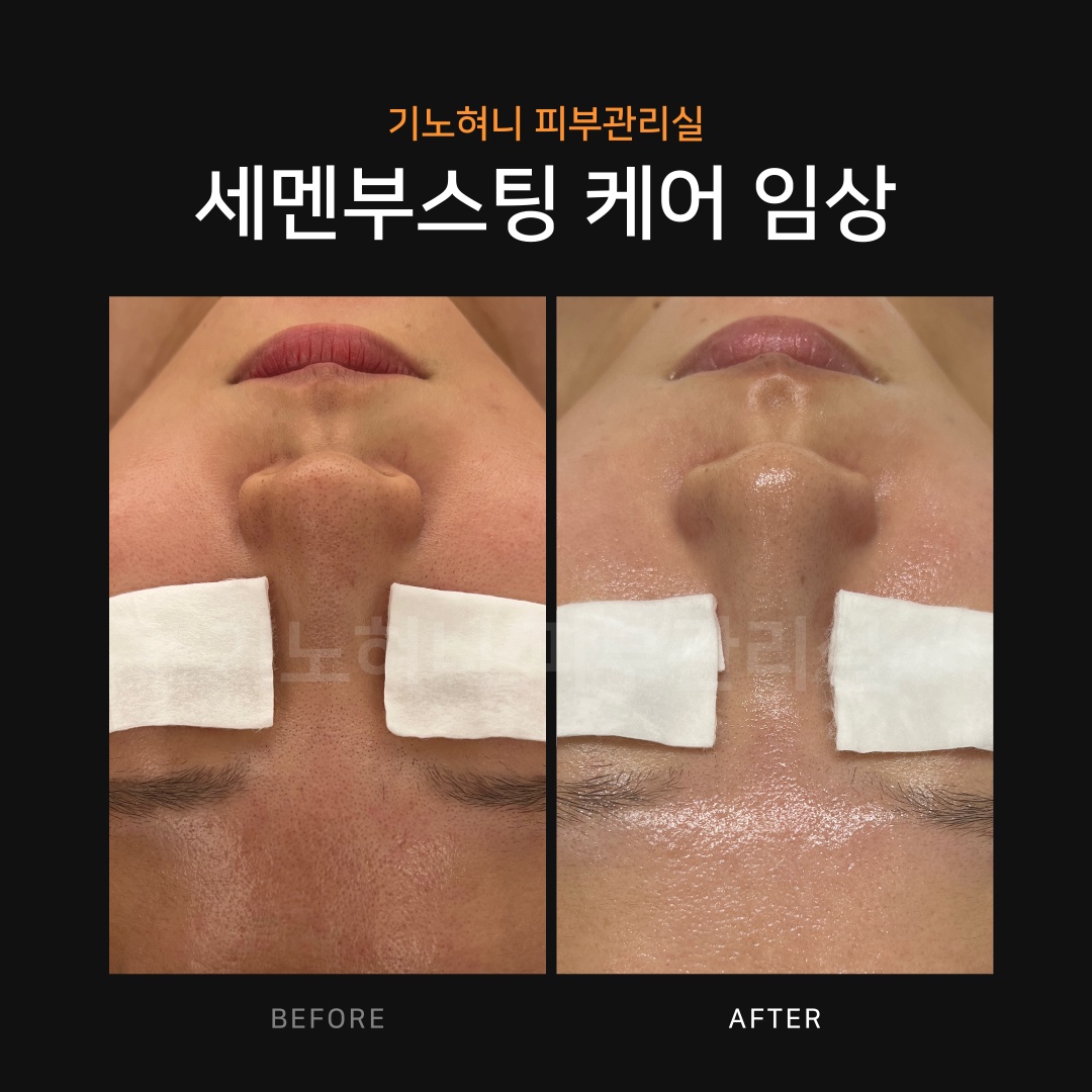 기노혀니피부관리실