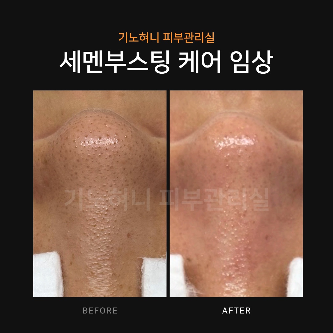 기노혀니피부관리실