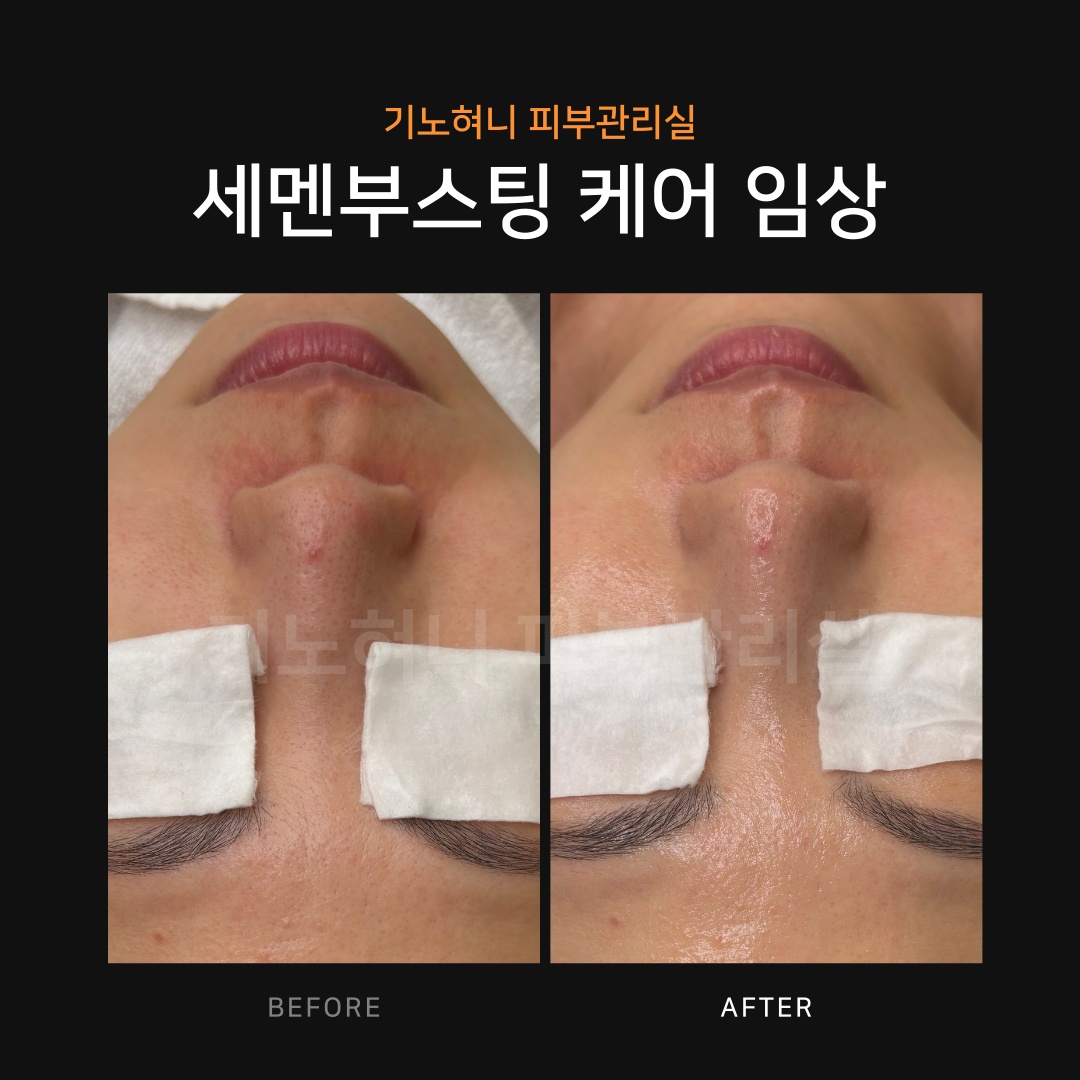 기노혀니피부관리실