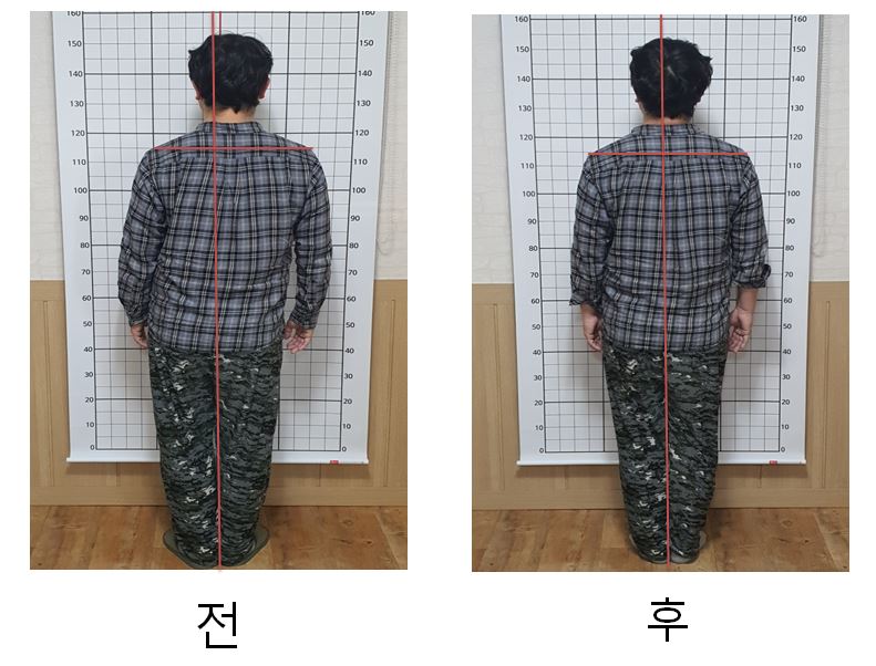 몸편한교정센터 photo 3