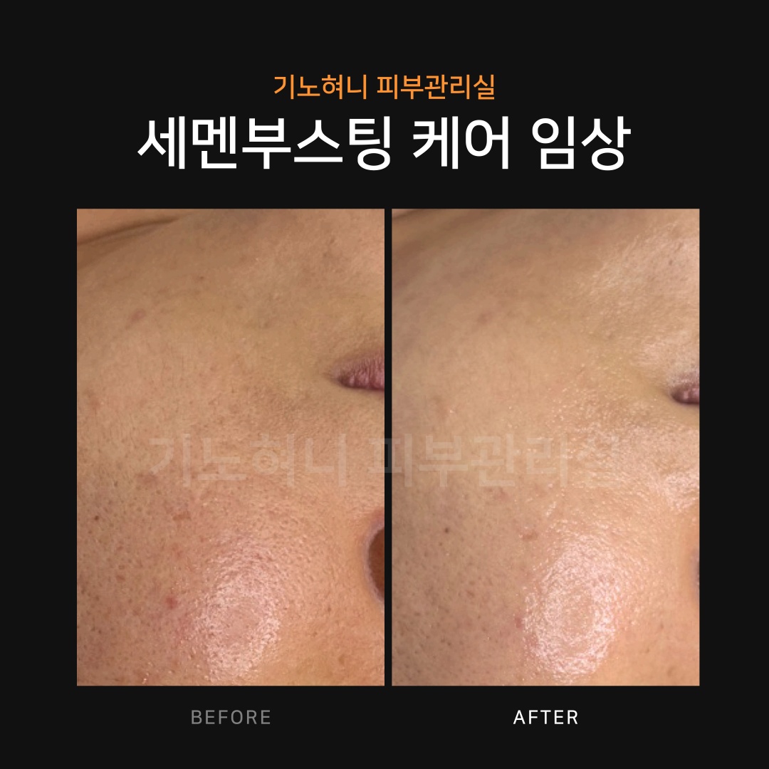 기노혀니피부관리실