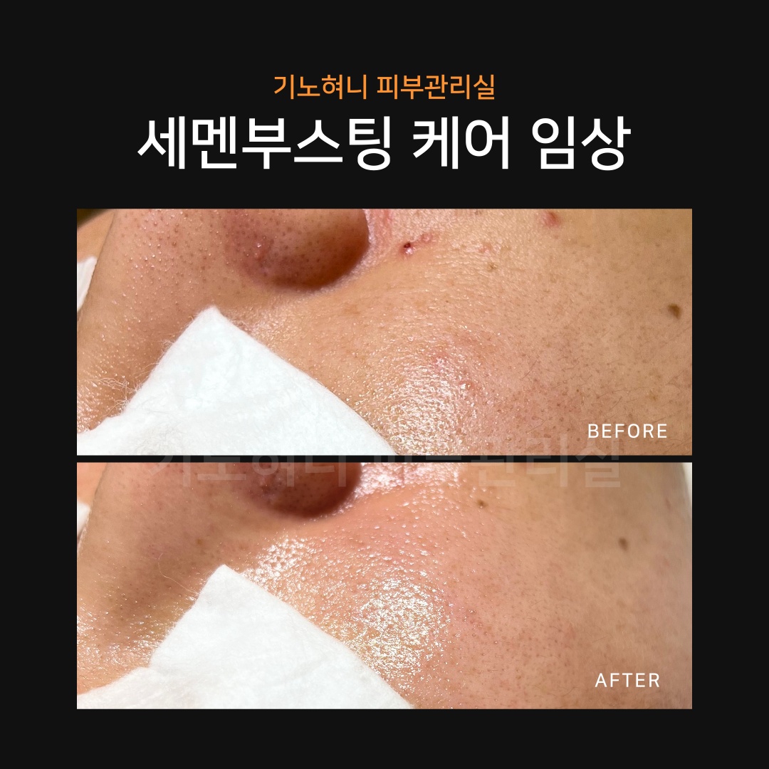기노혀니피부관리실