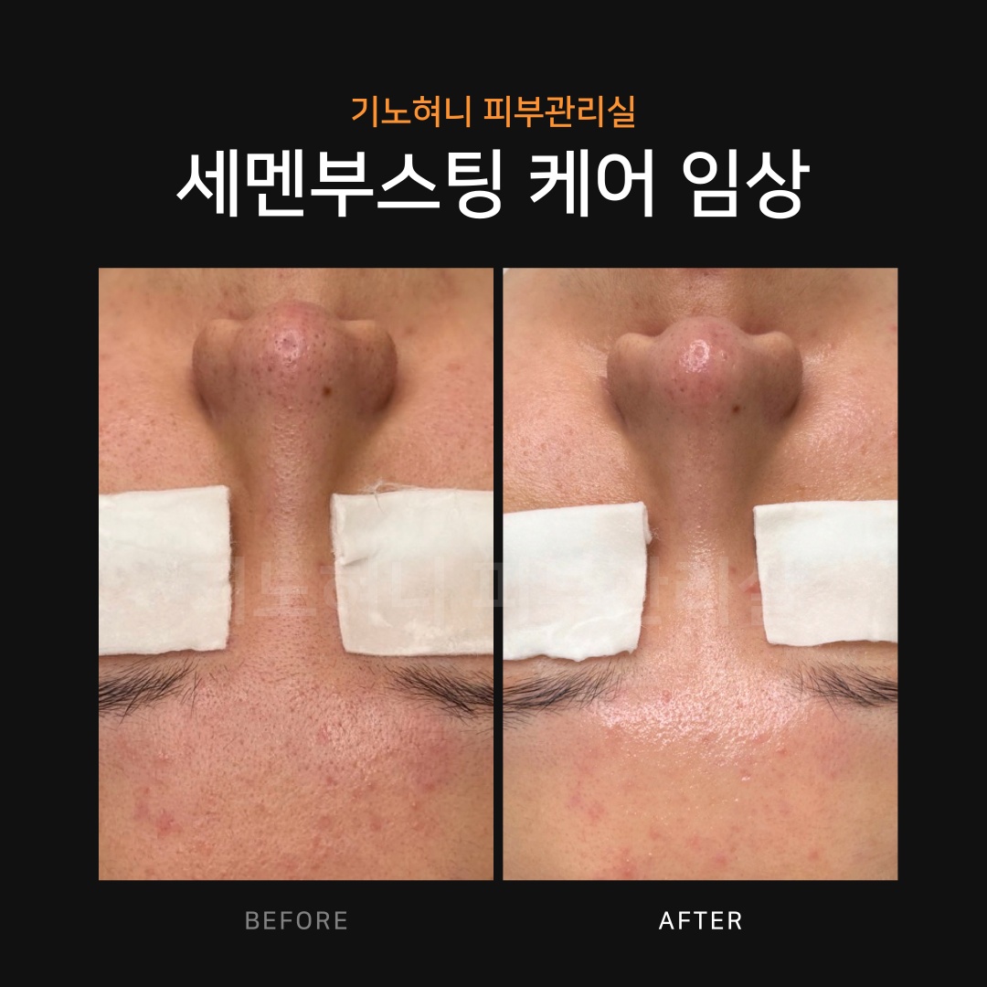 기노혀니피부관리실