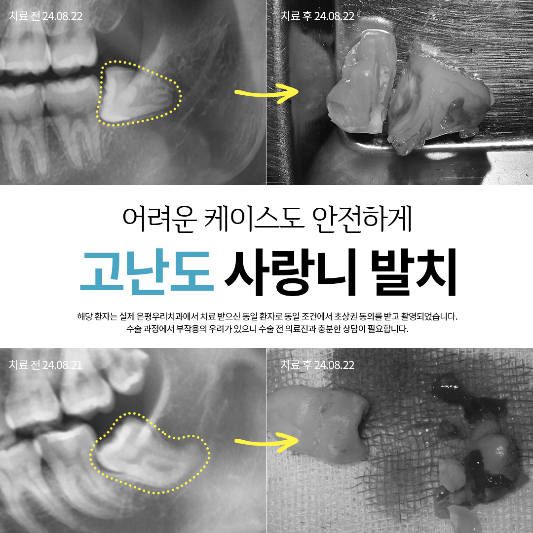은평우리치과의원 내부 전경