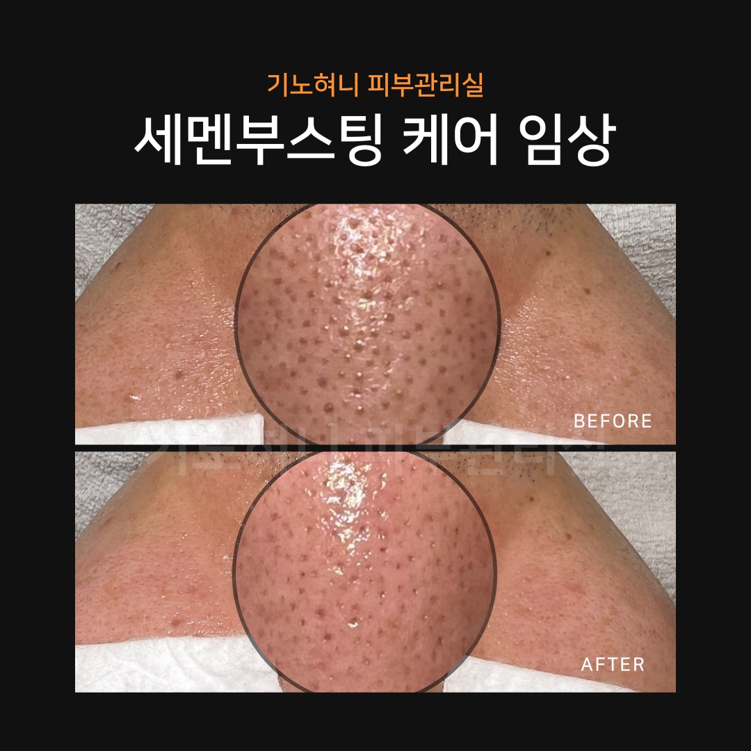 기노혀니피부관리실