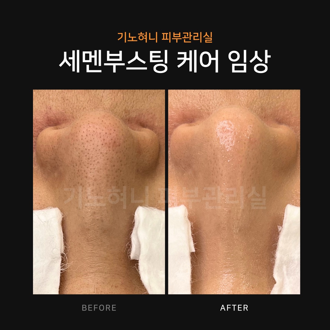 기노혀니피부관리실