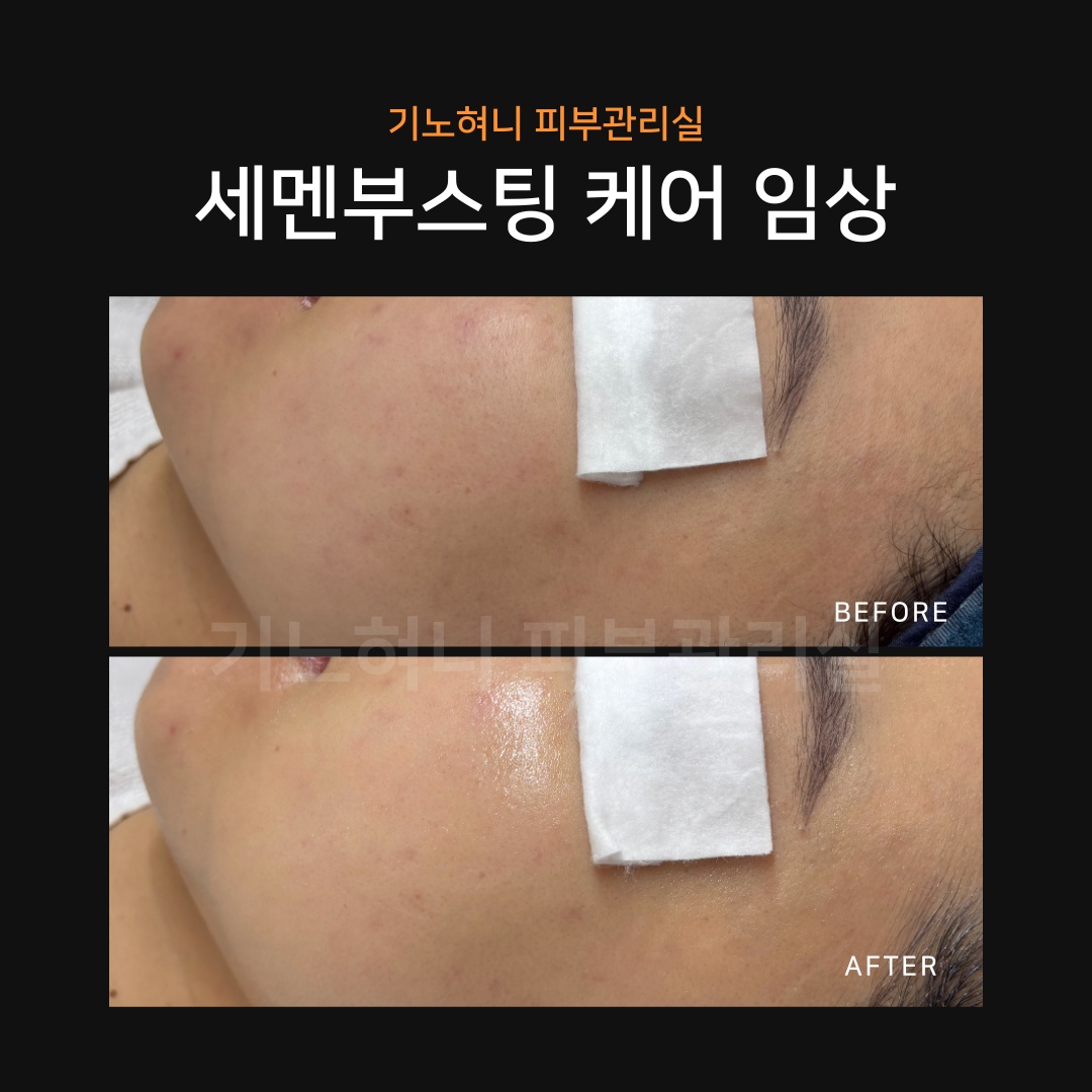 기노혀니피부관리실