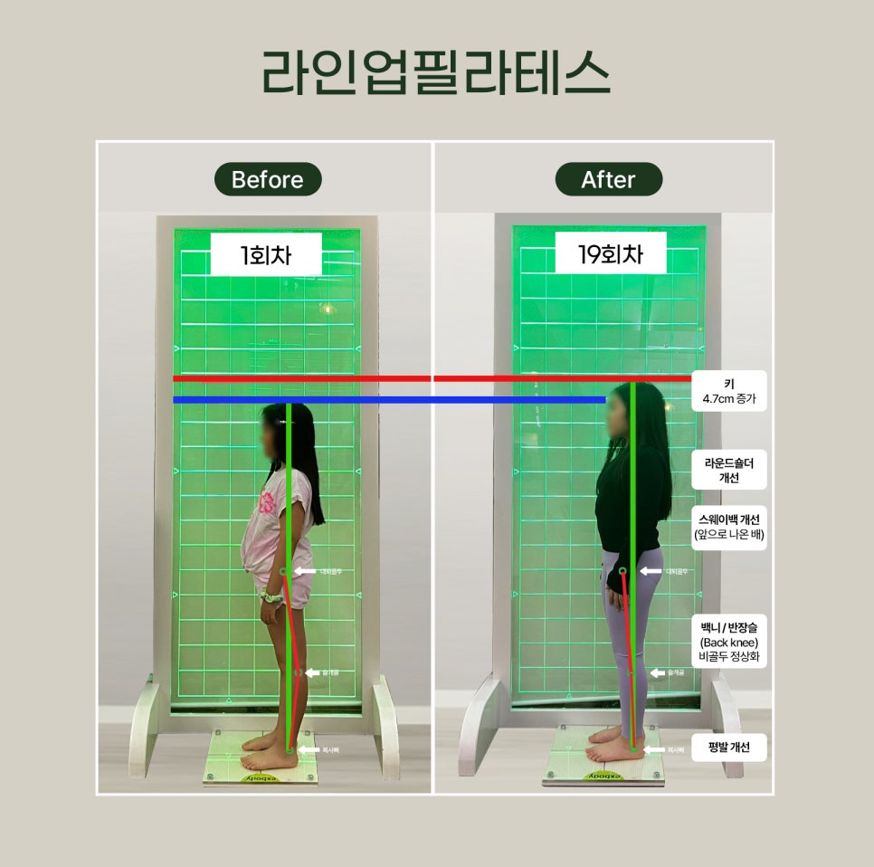 라인업필라테스&체형관리스튜디오 대표 이미지