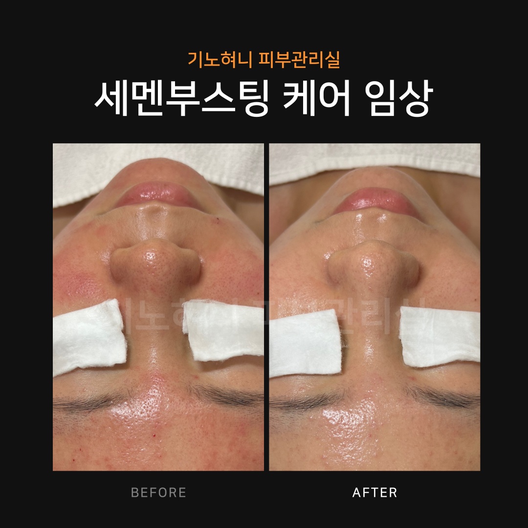 기노혀니피부관리실
