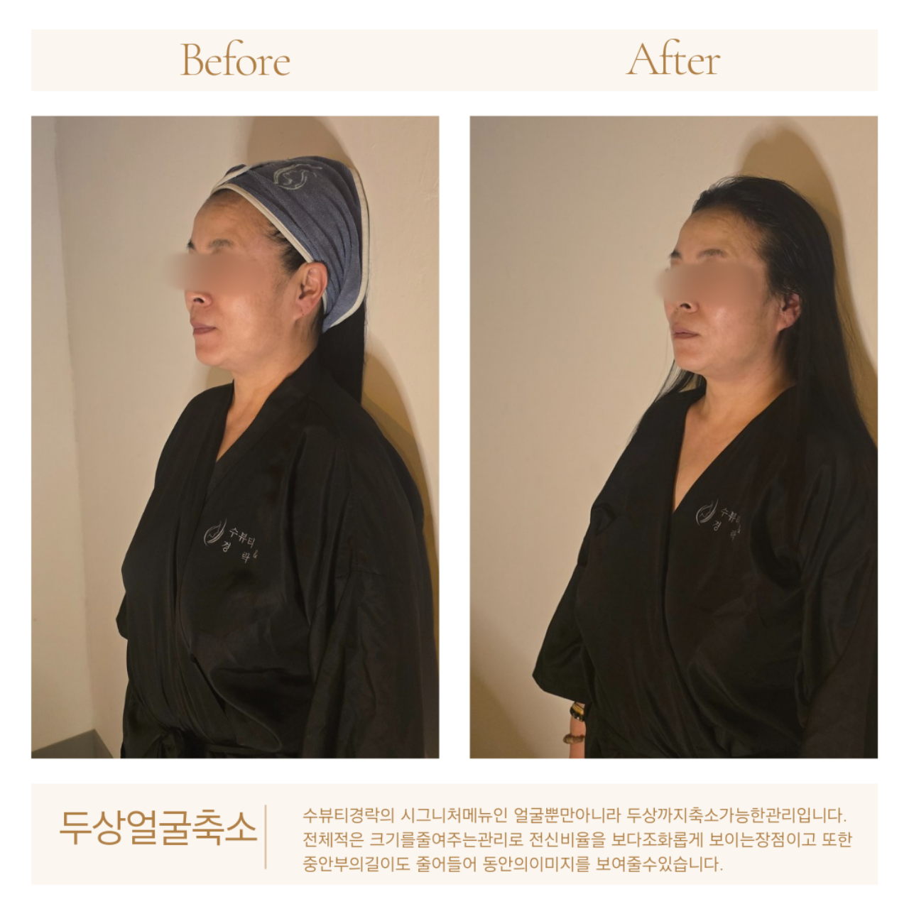 수뷰티피부앤경락 평택마사지