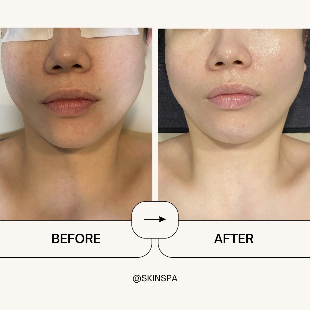 스킨스파 명동본점 대표 이미지