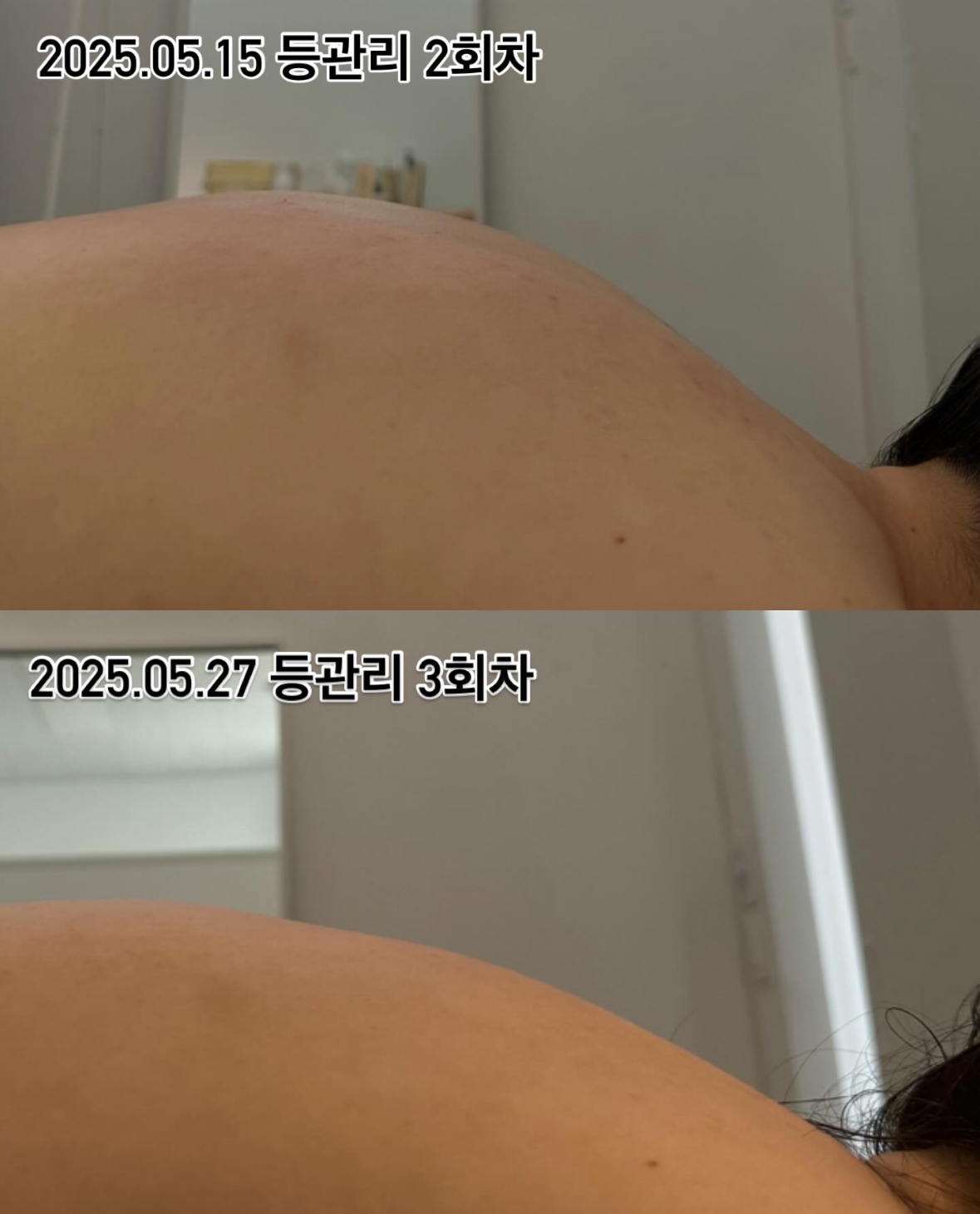 로아뷰티 대표 이미지