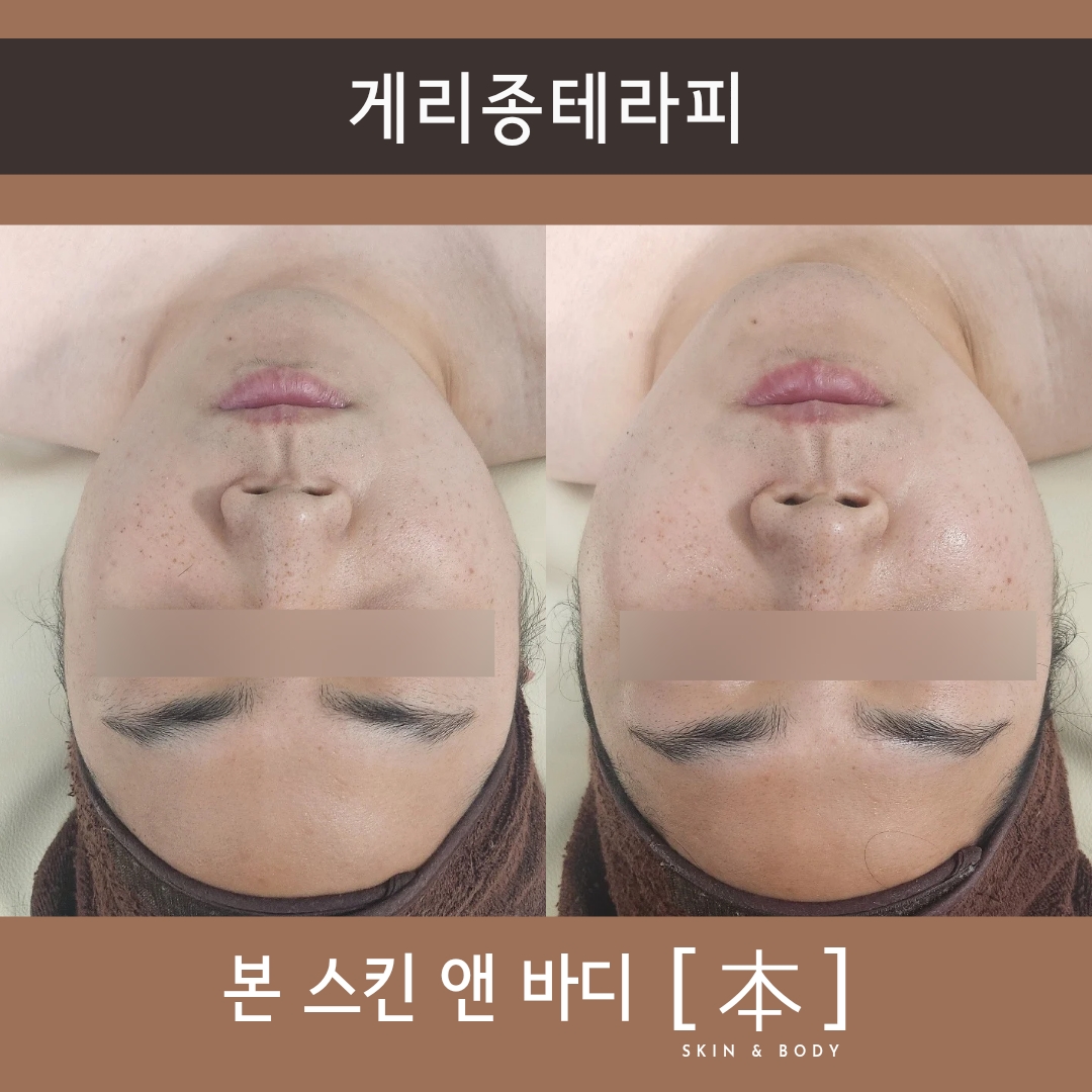 본스킨앤바디