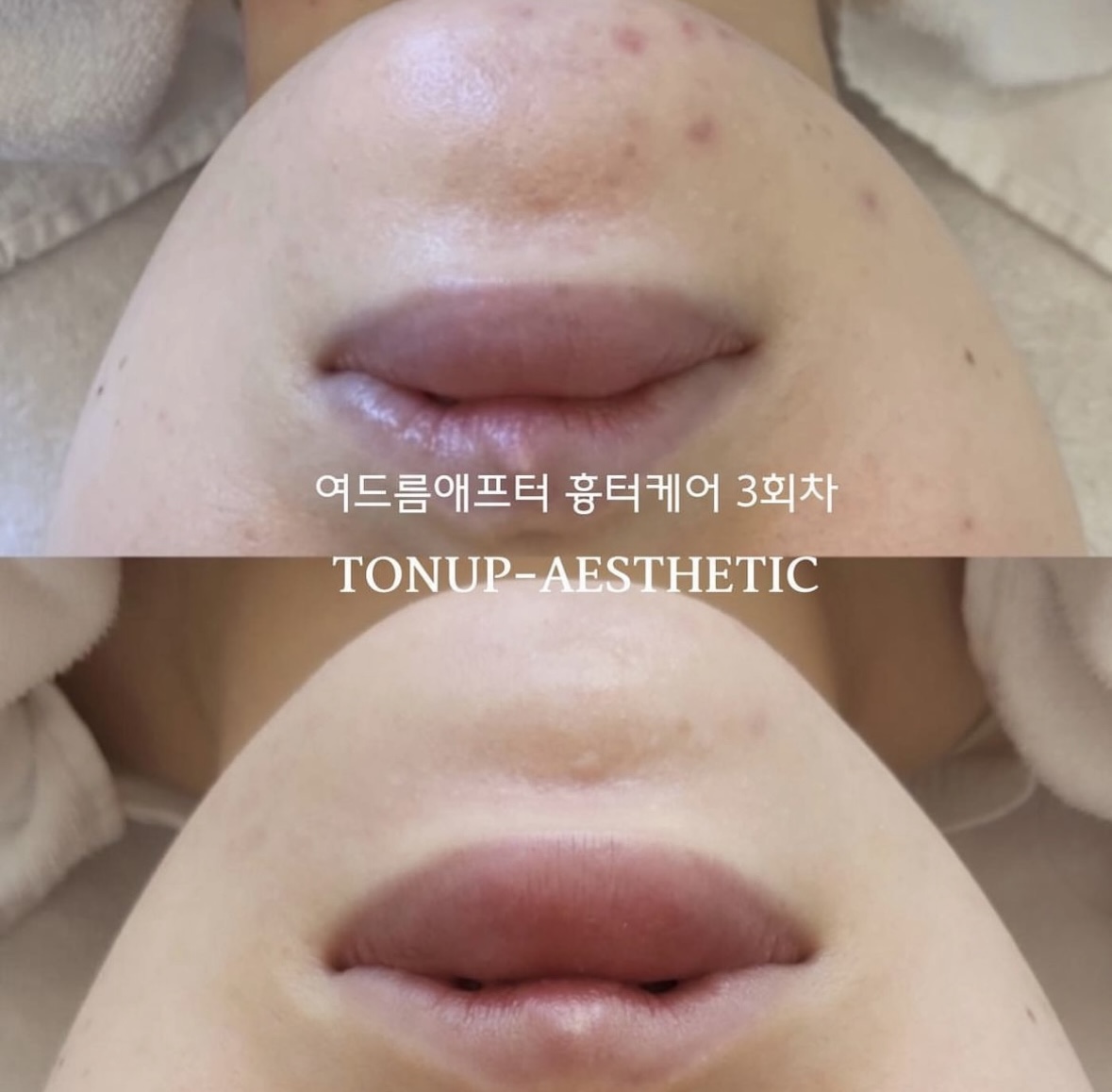 톤업에스테틱 청주용암점 대표 이미지