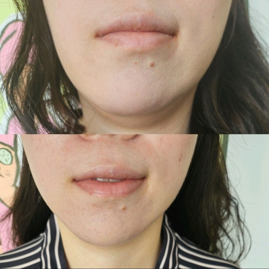 바른몸 photo 4