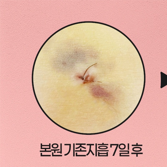 뽐나게빼의원 대표 이미지