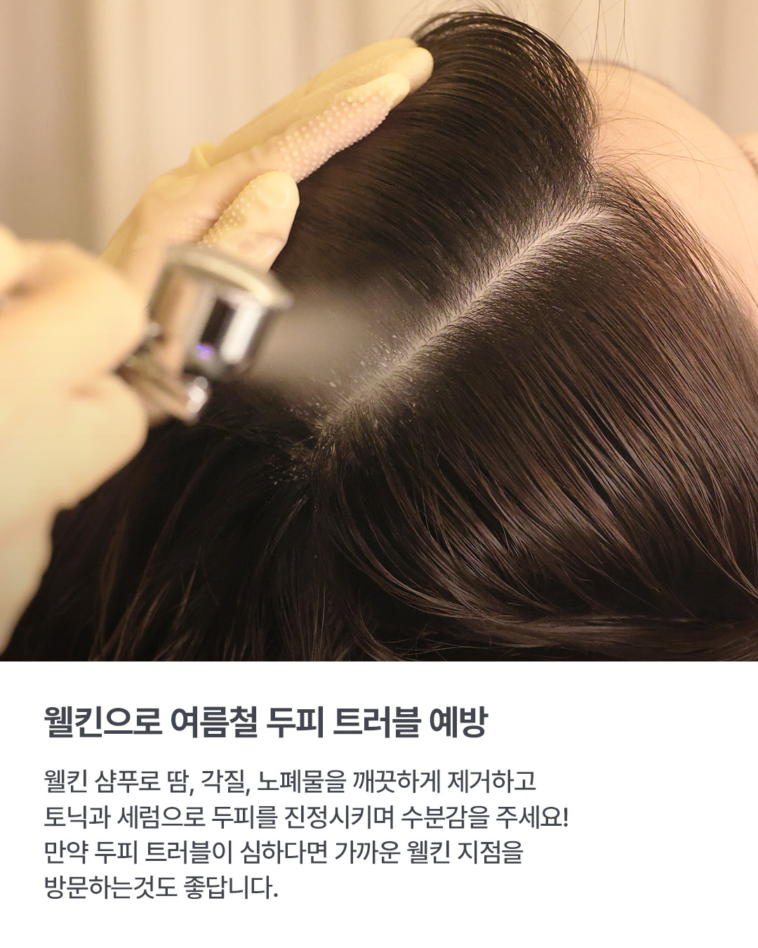 웰킨 두피탈모센터 종로점 대표 이미지