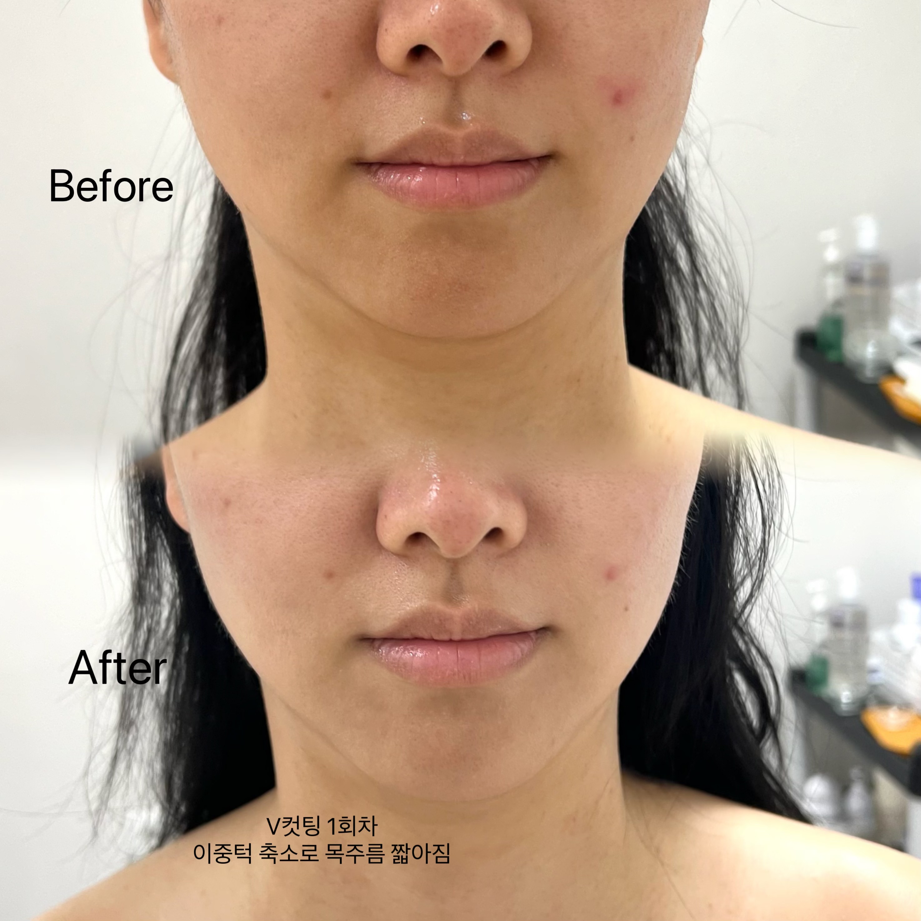 더마드스튜디오 구미형곡점