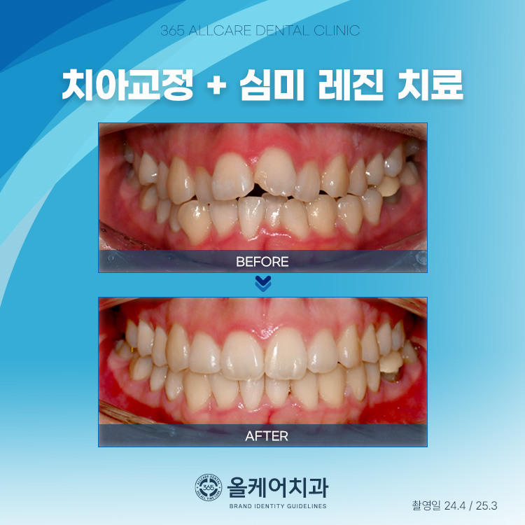 365올케어치과의원 대표 이미지