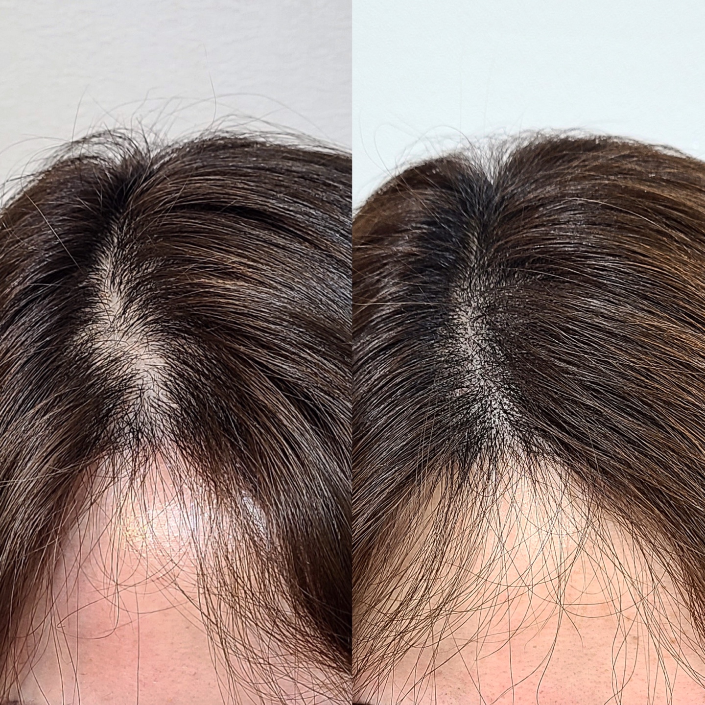 뷰티러스 대표 이미지