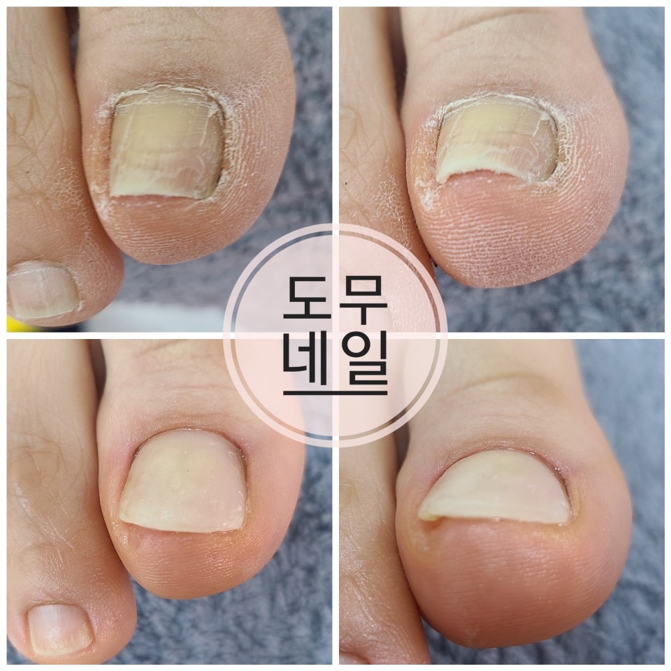 도무네일 대표 이미지