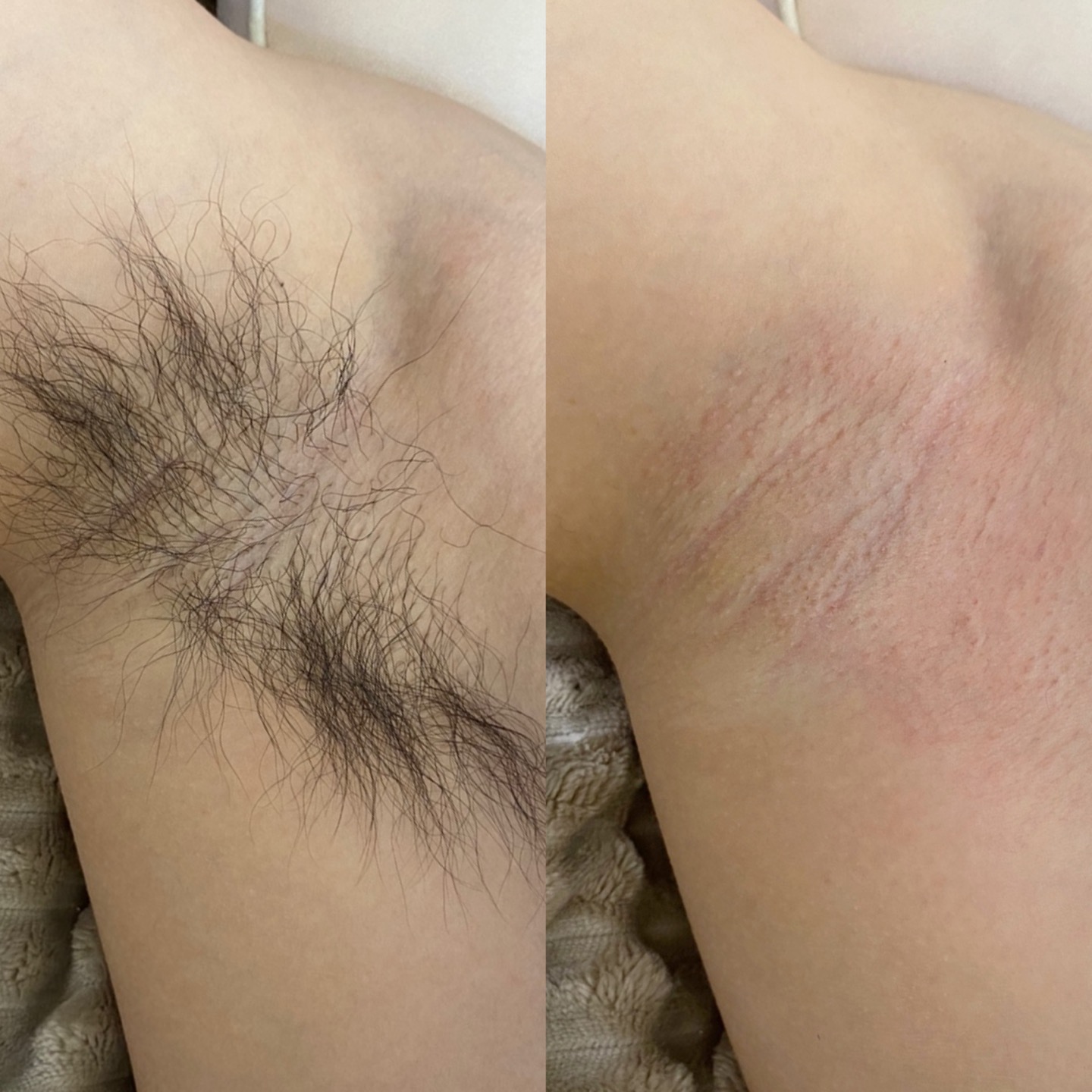 모적감각 대표 이미지