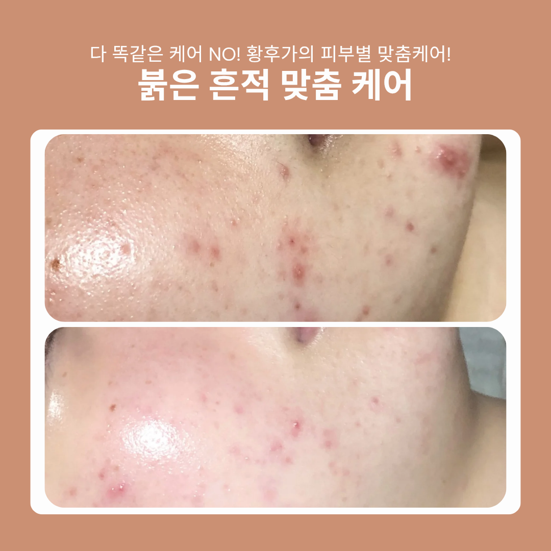 황후가
