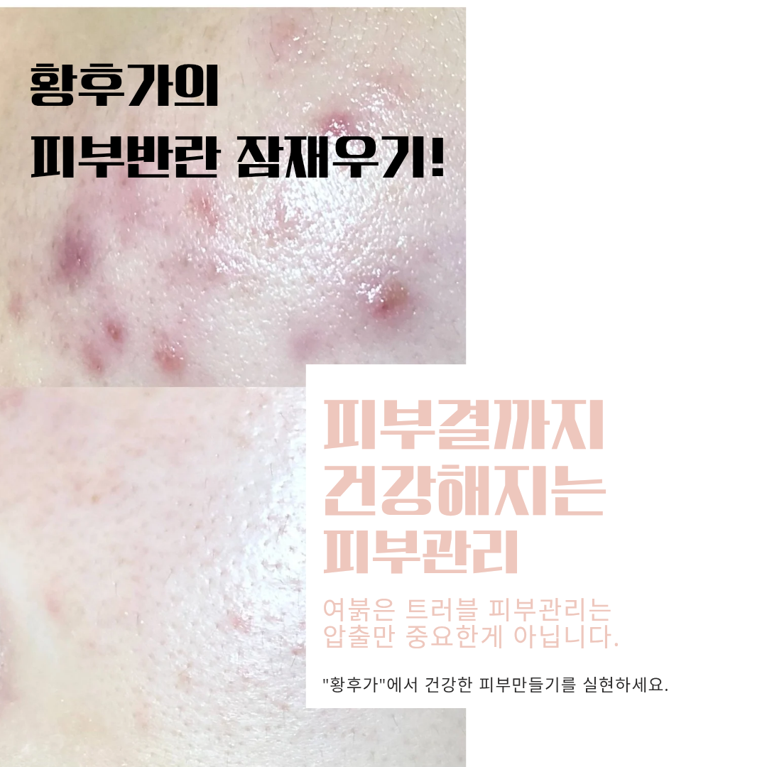 황후가
