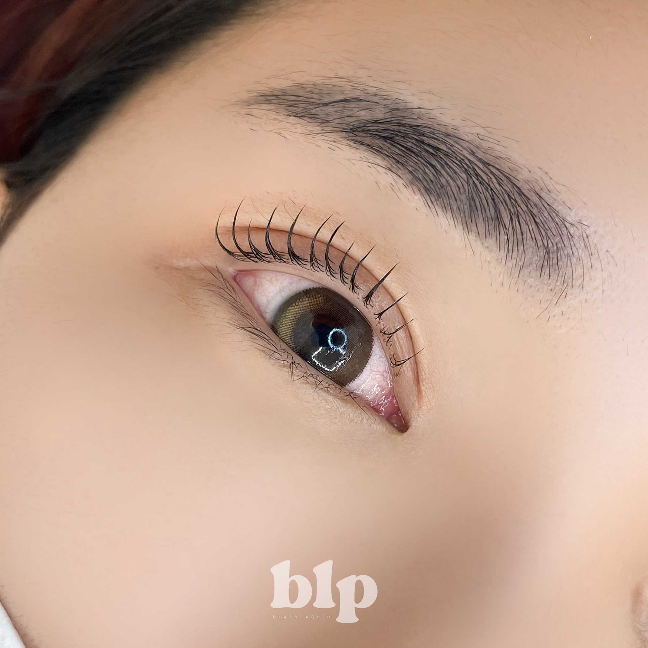 비엘피 대표 이미지