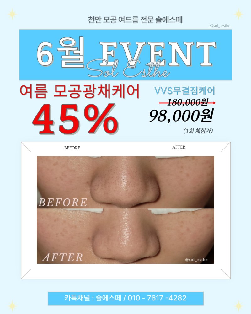 솔에스떼 불당동 에스테틱