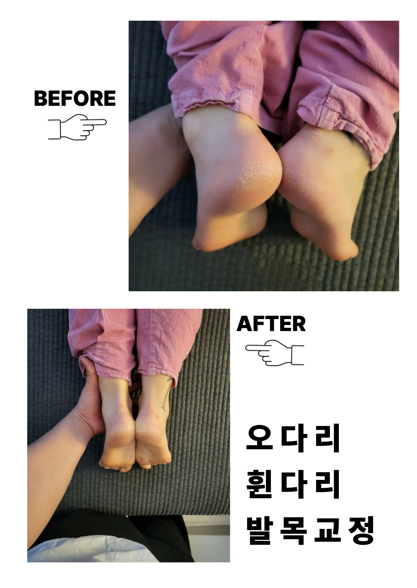 더드림 바디케어