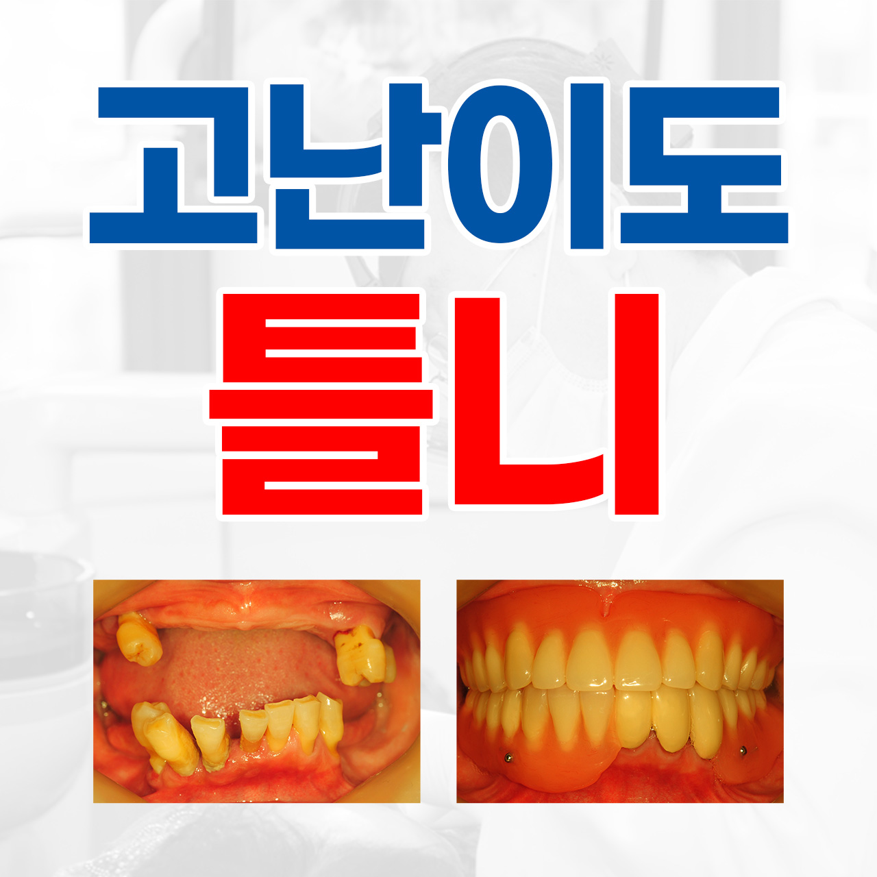 벤틀니치과의원 대표 이미지