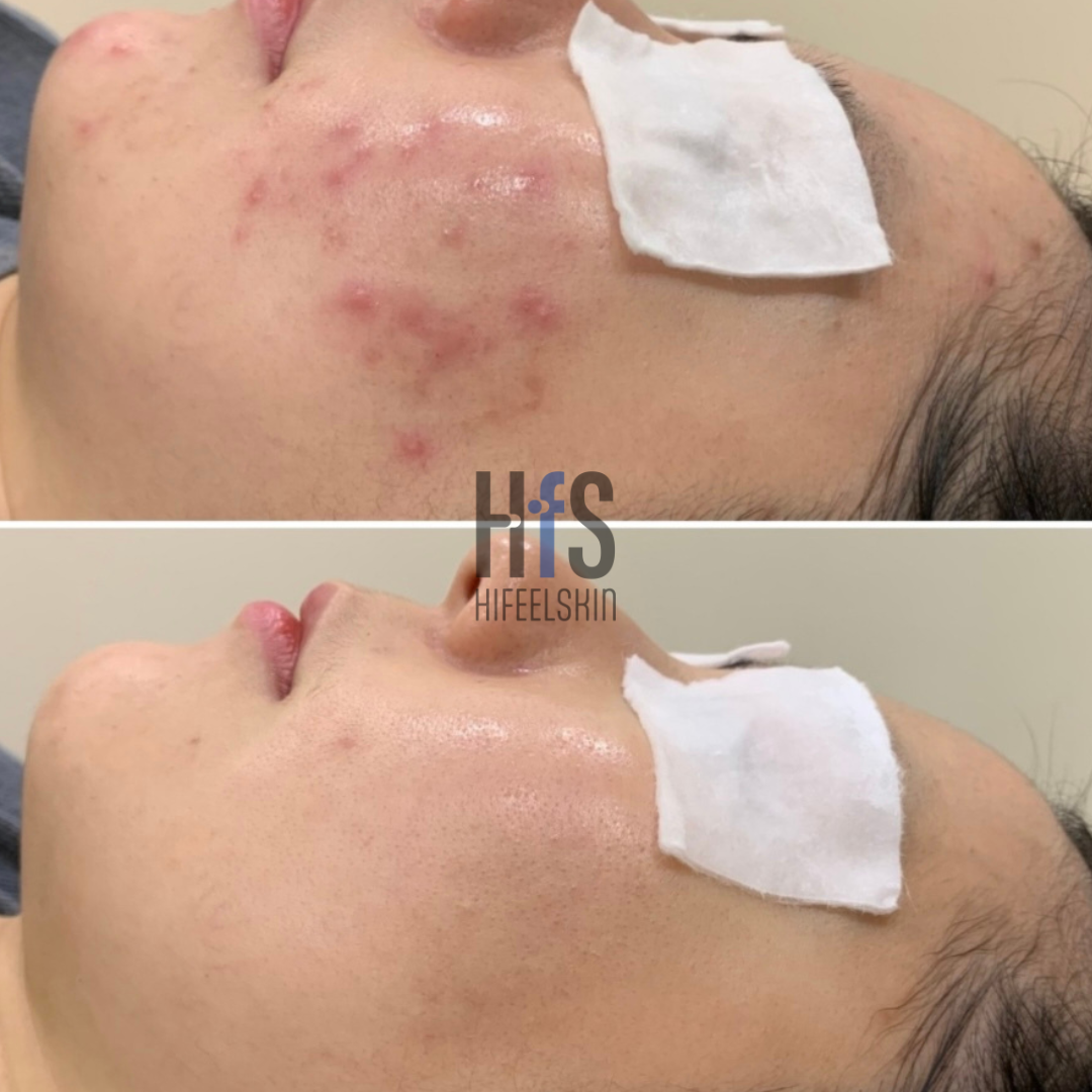 하이필스킨 여의도점 대표 이미지