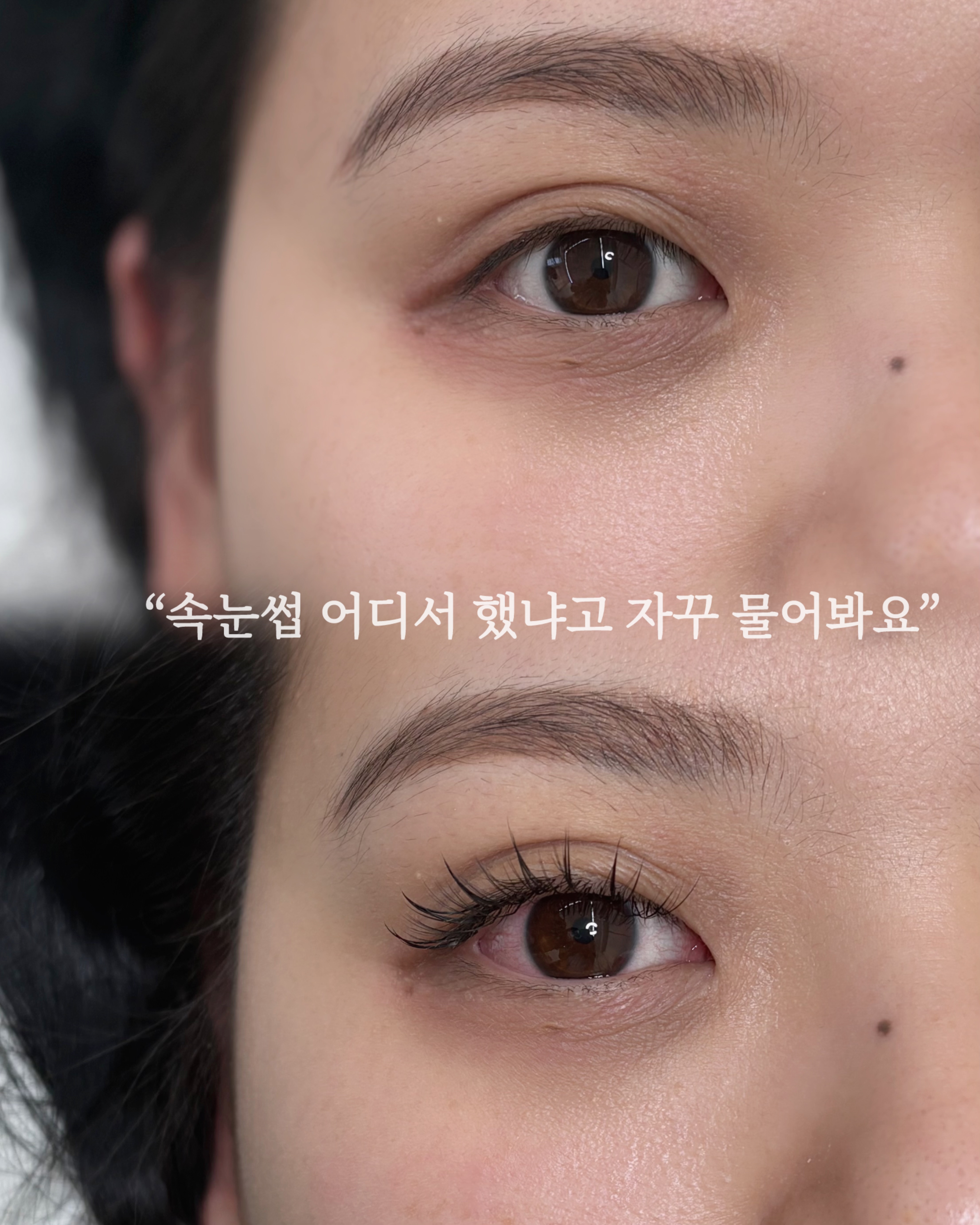 바비인뷰티 강남본점 대표 이미지