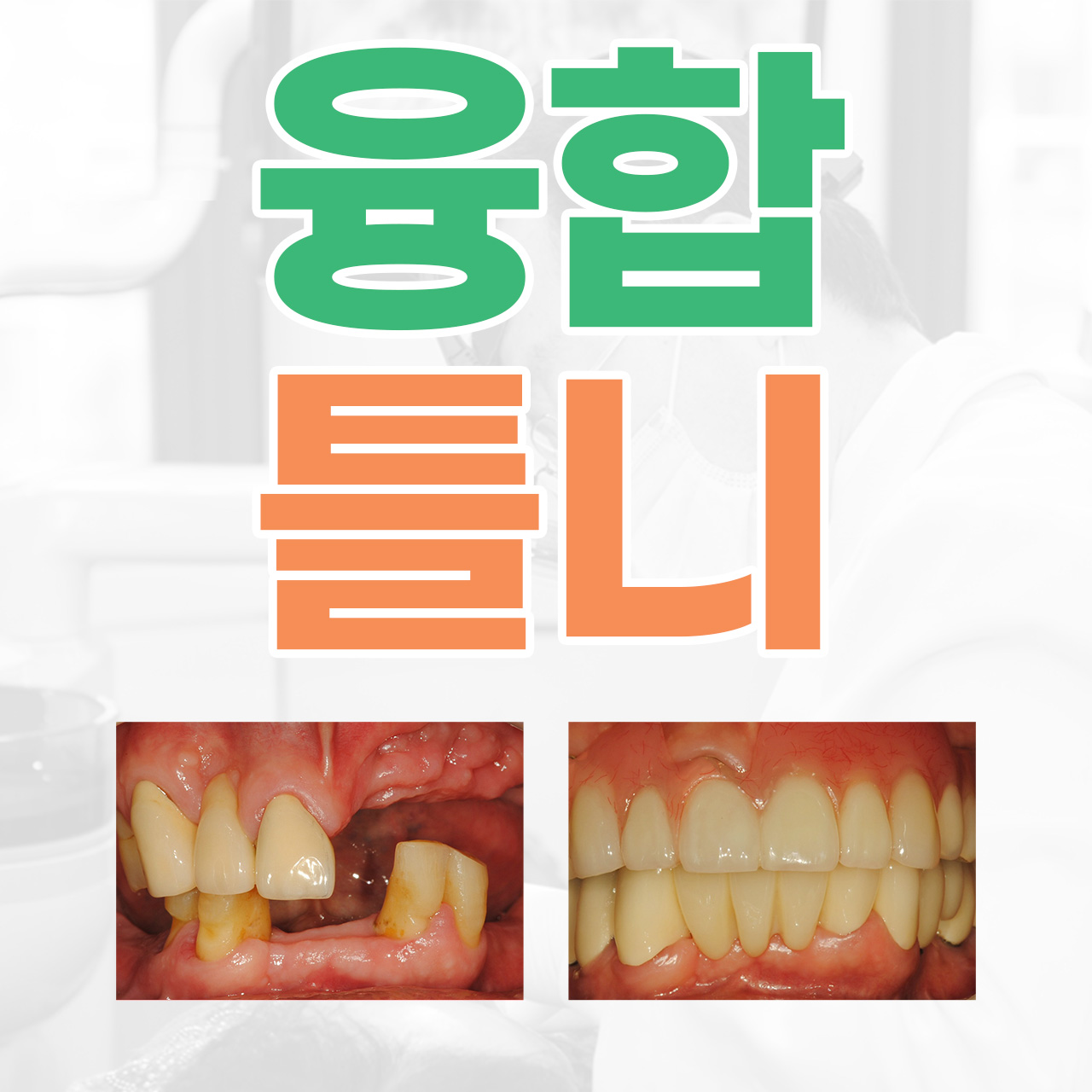 벤틀니치과의원 대표 이미지