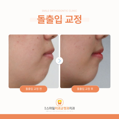 스마일