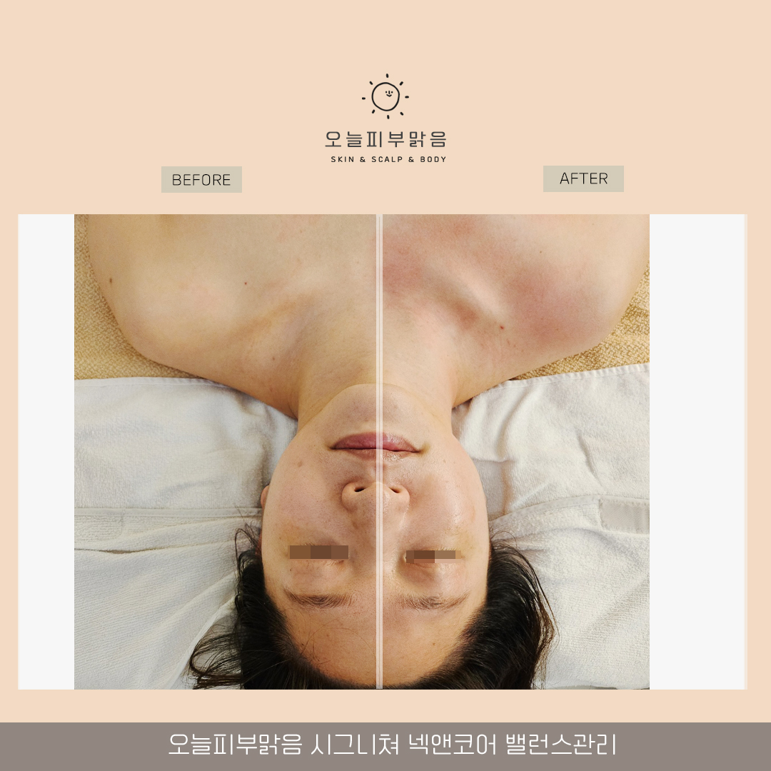 오늘피부맑음 photo 9