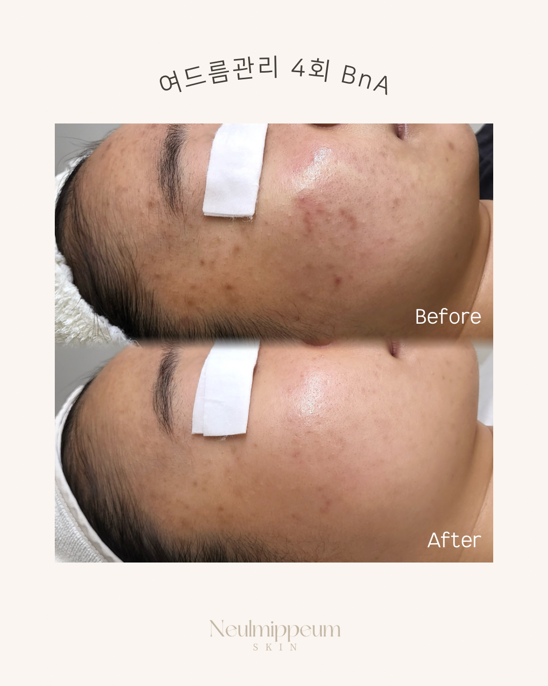 늘미쁨스킨 대표 이미지