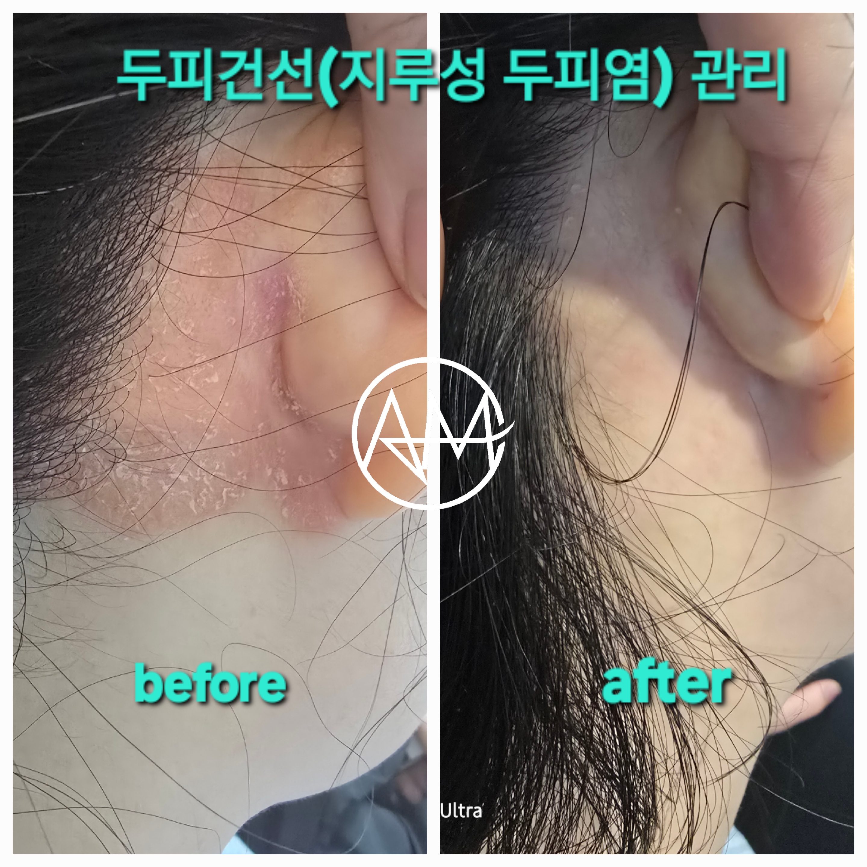 아로모 탈모 두피클리닉 대표 이미지