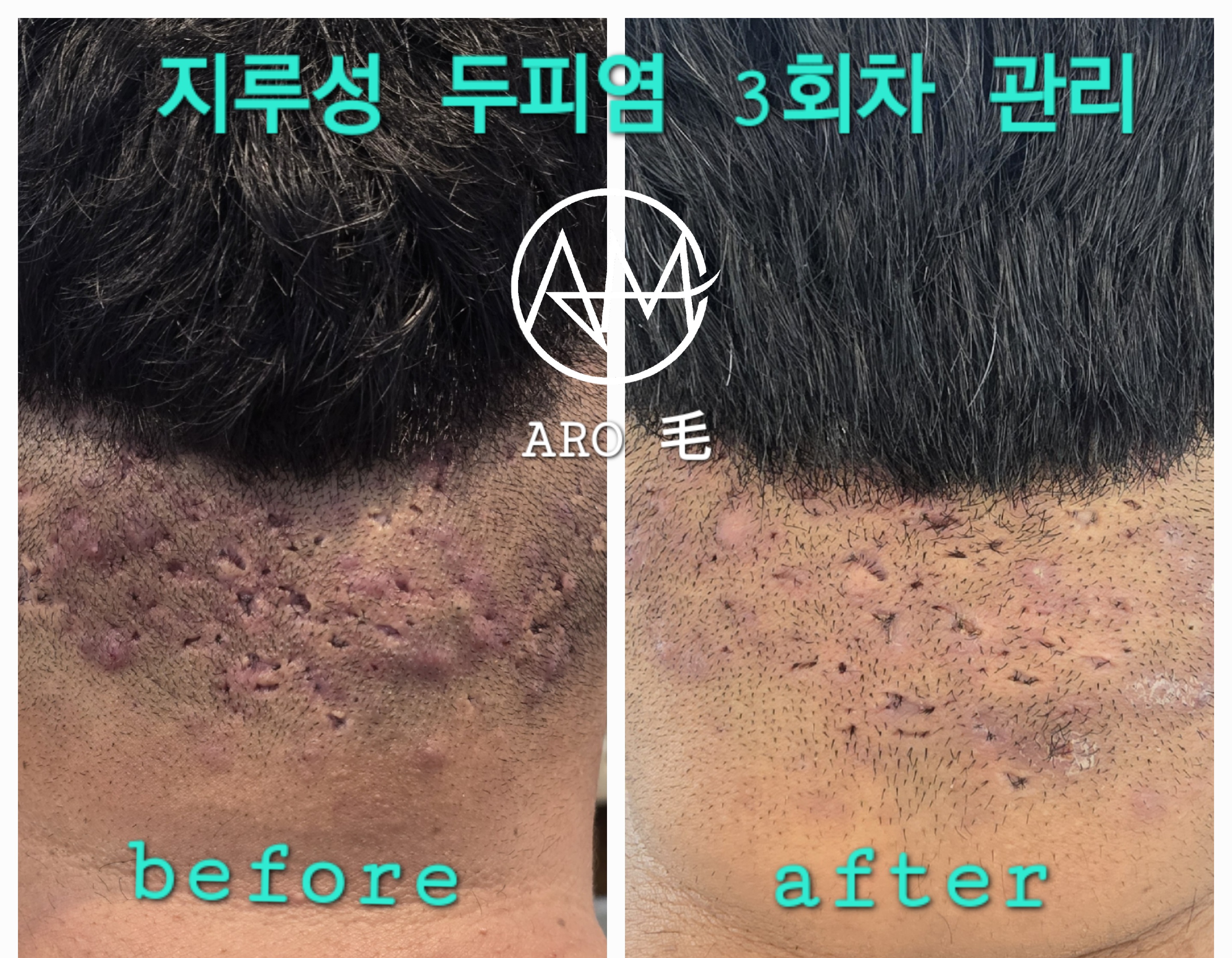 아로모 탈모 두피클리닉 대표 이미지