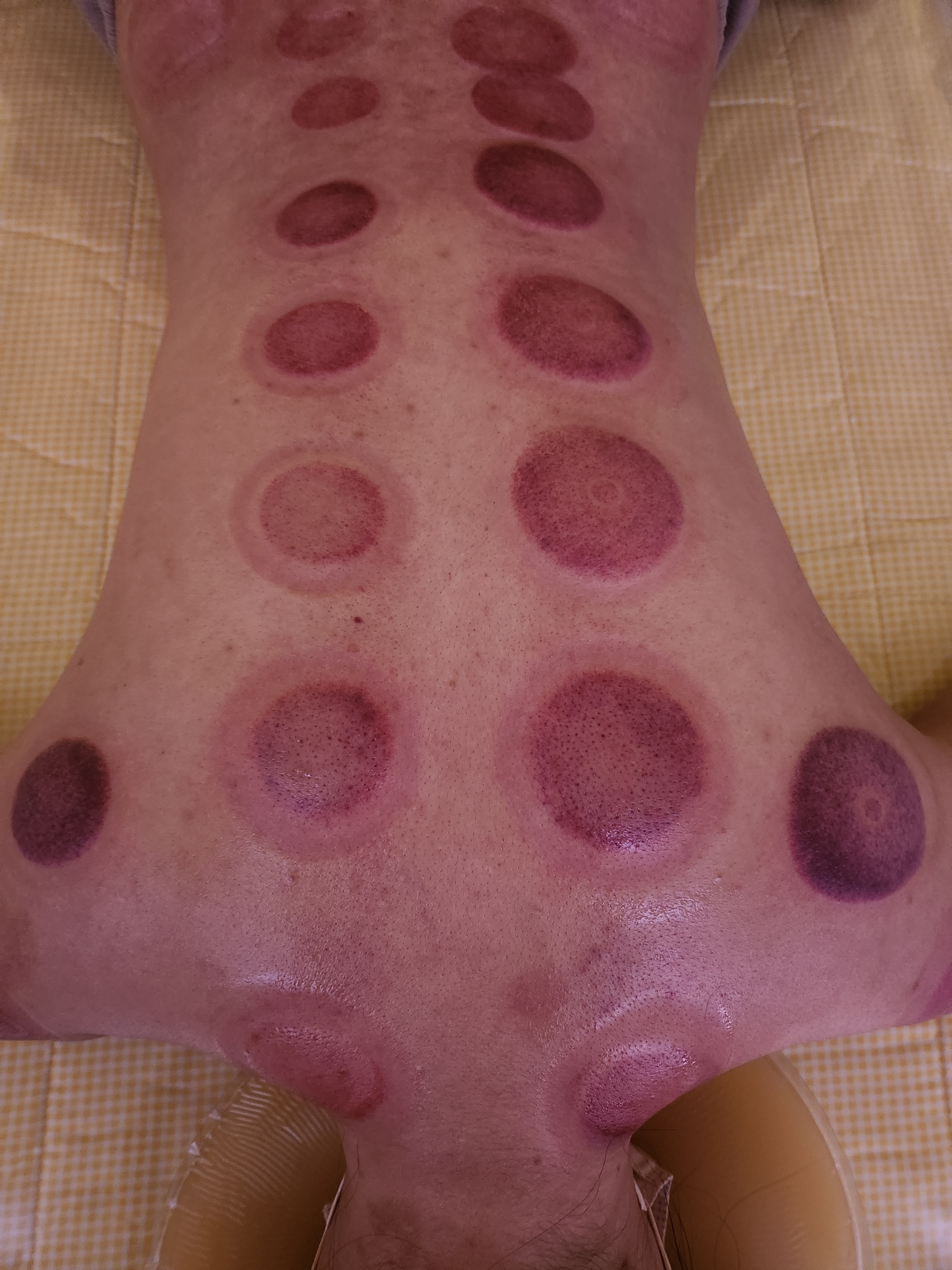 바디힐 photo 7