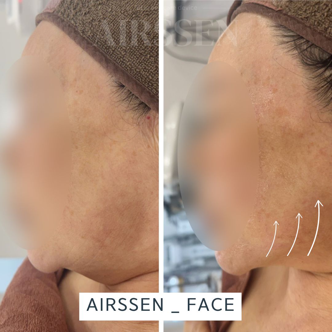 리턴스킨 대표 이미지