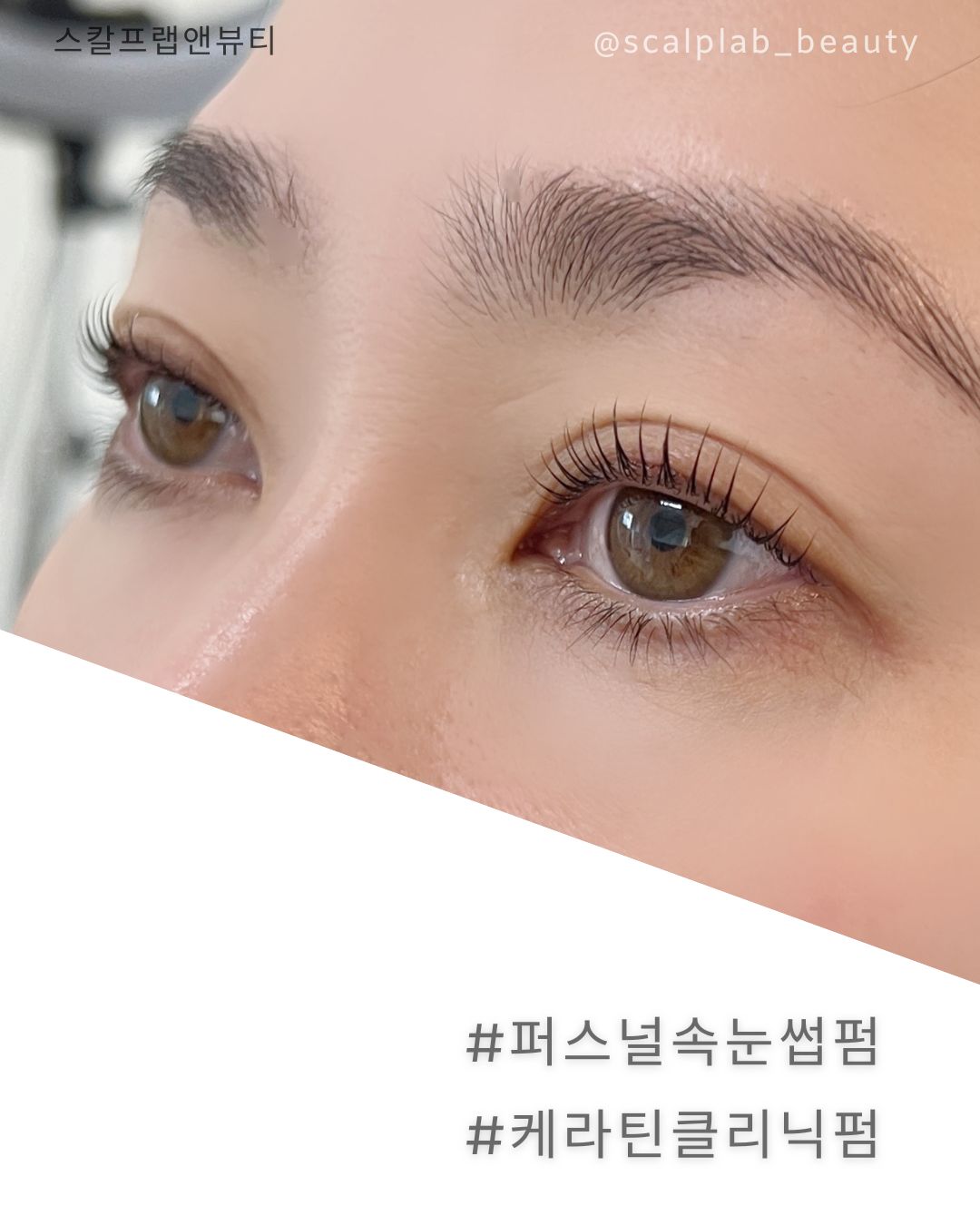 스칼프랩앤뷰티 속눈썹&눈썹&탈모 의정부점