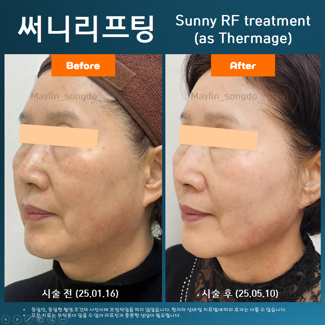 메이린의원 송도 대표 이미지