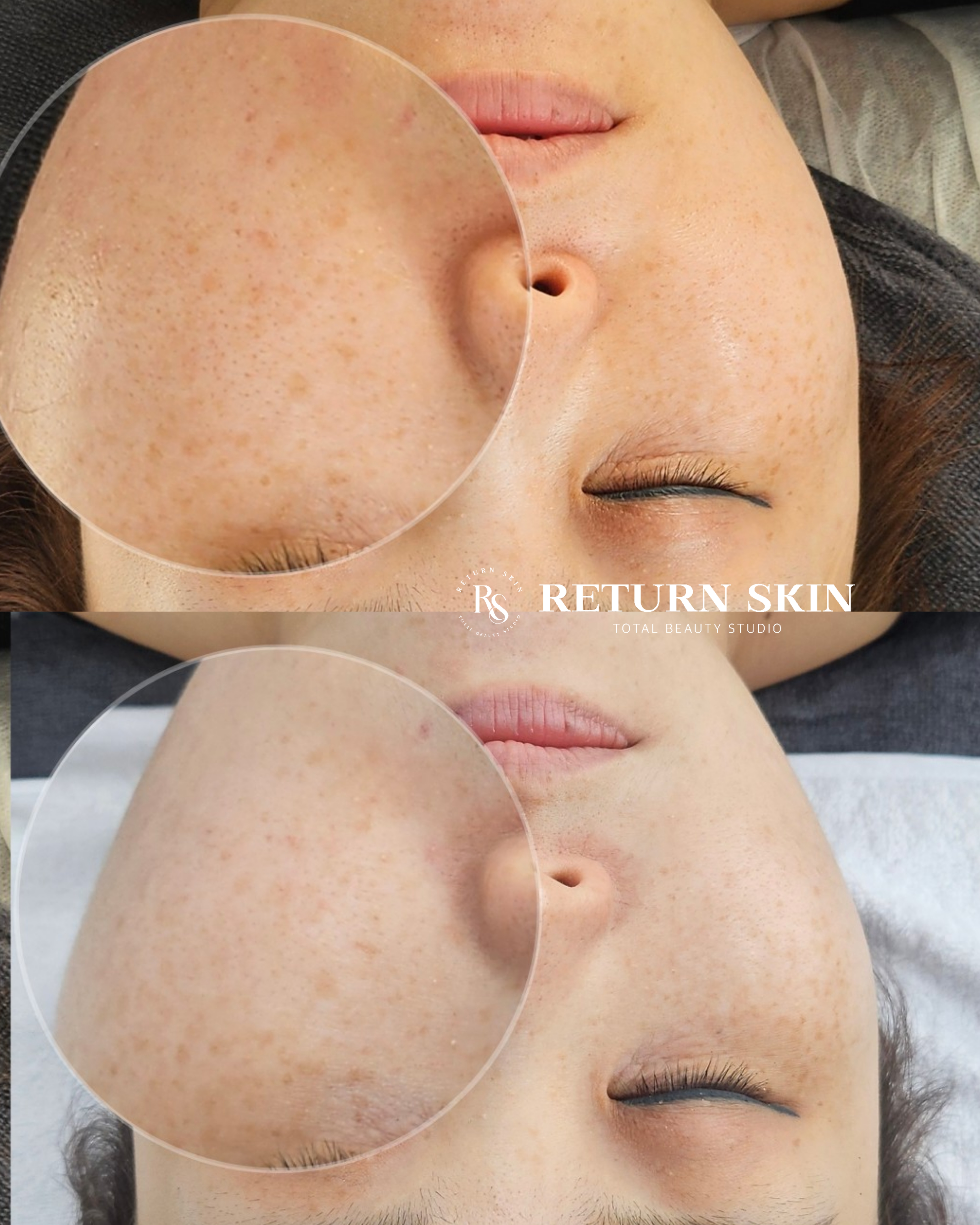 리턴스킨 대표 이미지