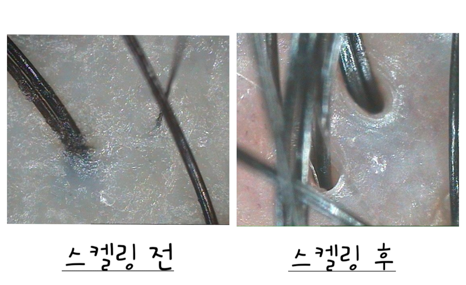 라인두피 대표 이미지