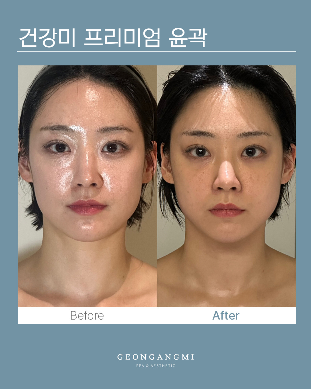 건강미스파 청담점 photo 5