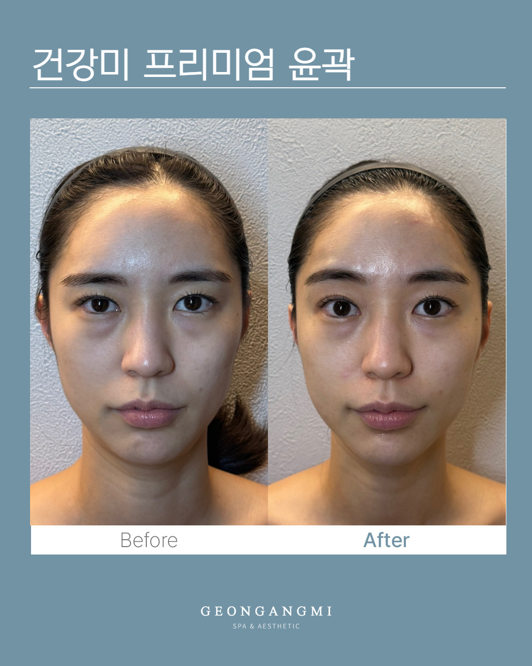 건강미스파 청담점 photo 3